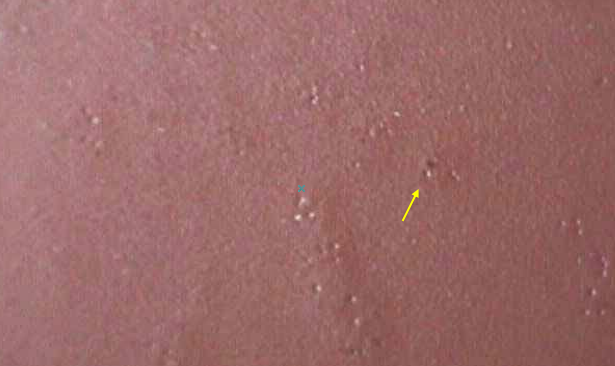 Coating pinholes/coating sags should be handled this way!  Picture 1